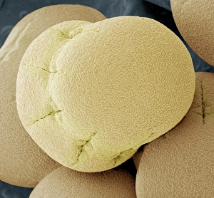 SEM Images Of Pollen Stampe: Comfrey pollen, SEM