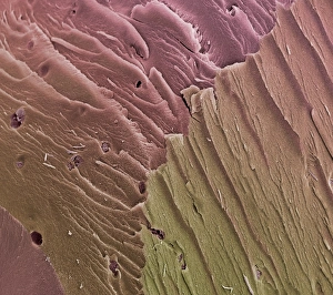 Knee Joint Anatomy Stampe: Compact bone, SEM