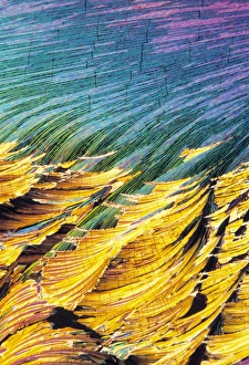 Polarised Light Microscopy Stampe: Cortisol crystals, light micrograph
