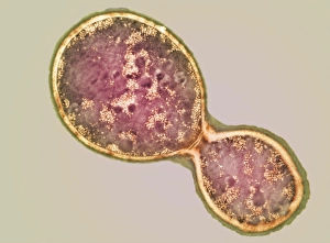 Immagini datate 2002 agosto: Cristallo di Cryptococcus in fase di divisione cellulare con microscopia elettronica a trasmissione (TEM)