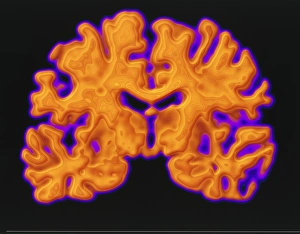 Cerebrum Structure Stampe: CT scan of brain