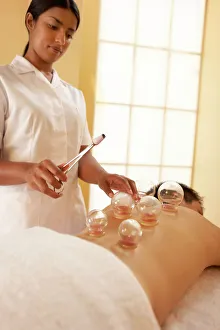 Stampe di MODEL RILASCIO DELLA LIBERTÀ D'USO. Cappettinatura. Il terapeuta calda le ciotole di vetro su la schiena del cliente Immagini datate 2006 aprile: Cupping