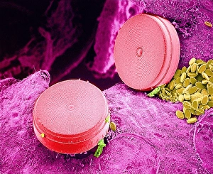 Scanning Electron Micrograph Of Diatoms Stampe: Diatom algae, SEM