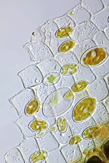 Diatom Micrograph Stampe: Diatoms, light micrograph