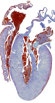 Heart Anatomy Stampe: Dissected heart, light micrograph