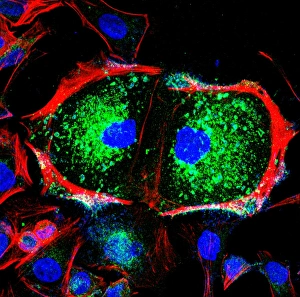 Light Micrograph Images Stampe: Dividing cell, light micrograph
