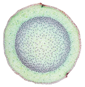 Vascular Bundle Structure Stampe: Dragon tree stem, light micrograph