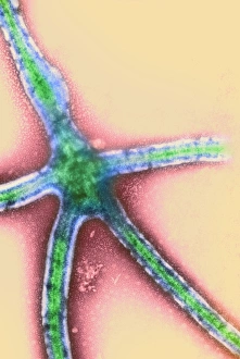 Stampe di Replicazione del virus Ebola, immagine a trasmissione elettronica (TEM) Immagini del 22 aprile 2003: Riproduzione del virus Ebola, immagine a trasmissione elettronica microscopica (TEM)