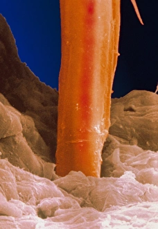 Stampe di Il cefale fuga stiletto Immagini datate 1995: Microfotografia elettronica di stilettini della ciotola del gatto nella pelle