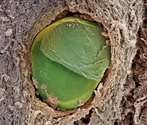 Coloured SEM Images Stampe: Embolism
