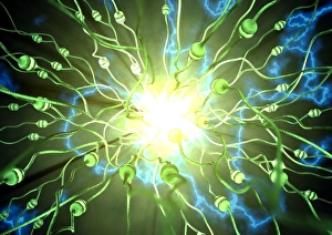 Stampe di Epilessia. Arte computerizzata concettuale di un cervello durante una crisi epilettica. I neuroni (cellule nervose) sono verdi. L'epilessia è attività elettrica anormale caotica nel cervello Immagini datate 2007 febbraio: Epilepsy