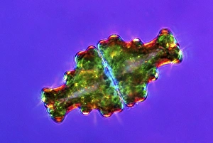 Polarised Light Microscopy Stampe: Euastrum desmids, light micrograph