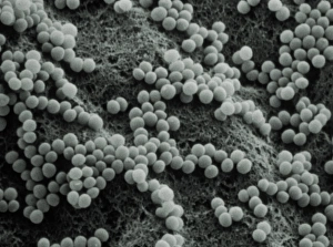 Staphylococcus Aureus Bacteria Stampe: False-col TEM of Staphylococcus aureus
