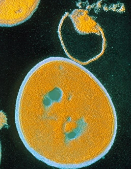 Stampe di Micrografo elettronico di trasmissione colorato (TEM) delle batterie Staphylococcus aureus che mostra un batterio completo (centro) Immagini datate 2003 febbraio: Colore falso della TEC di Staphylococcus aureus