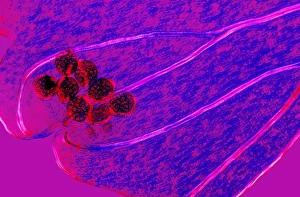 Polarised Light Micrograph Stampe: Fern spore cases, light micrograph
