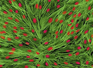 Light Micrograph Images Stampe: Fibroblast cells, light micrograph