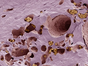 Scanning Electron Microscope Images Stampe: Fossilised compact bone, SEM