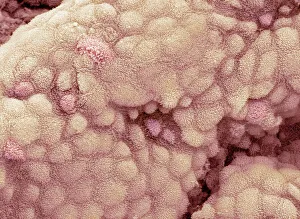 Coloured SEM Images Stampe: Gallbladder surface, SEM