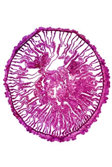 Light Micrograph Stampe: Gem anemone, light micrograph
