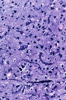 Glial Cells Stampe: Glial cells, light micrograph