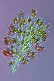 Immagini datate 8 marzo 2013: Alga d'oro, micrografo di luce
