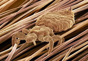 Stampe di Ciccia di testa. Immagine a raggi X colorata del microscopio elettronegativo con un insetto parassita umano della ciccia di capelli (Pediculus humanus capitis) Immagini datate 2000: Coda di pulga