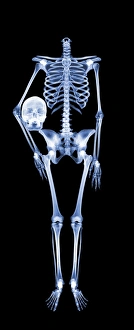 Stampe di Scheletro senza testa, radiografia di un scheletro che tiene la sua testa sotto il suo braccio Immagini datate 2006 dicembre: Scheletro senza testa