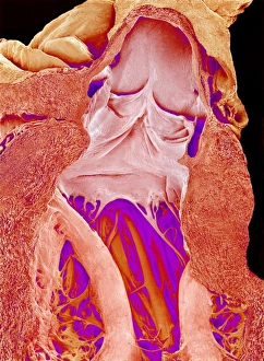 Stampe di Valvole cardiache e corde, micrografia a scansione di raggi X colorata. Questa dissezione mostra sia la valva mitrale (centro) che l'aortica (superiore centro) Immagini datate 2009 maggio: Valvole cardiache e corde, SEM
