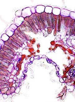 Drought Resistant Plants Stampe: Heather leaf, light micrograph