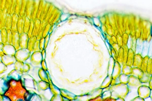 Drought Resistant Plants Stampe: Heather leaf stomata, light micrograph