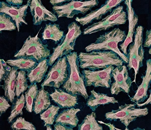 IL DNA Stampe: Cellule HeLa, fotografia a lente di ragno C013/4774