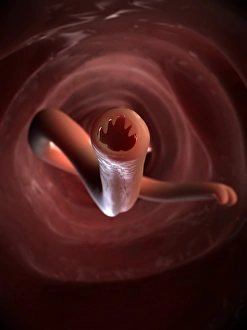 Intestinal Parasites Stampe: Hookworm, artwork