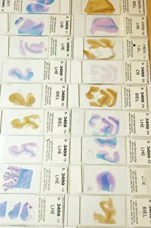 Immagini datate 2006: Microscopio del cervello umano