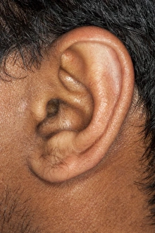 Human Ear Anatomy Stampe: Human ear C013 / 7319