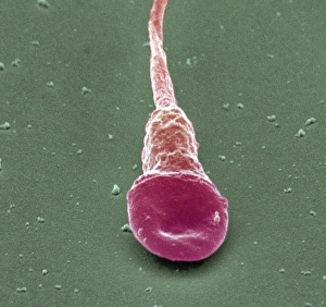 Coloured Scanning Electron Micrograph SEM Stampe: Human sperm cell, SEM