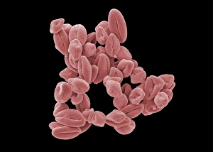 SEM Images Of Pollen Stampe: Hypericum pollen