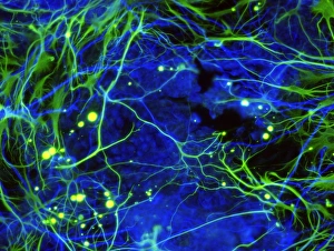 Stampe di Le staminali nervosi indotti. Micrografia di luce fluorescente dei staminali nervosi che sono stati creati (indotti) da cellule fibroblastiche dell'epidermide umana attraverso manipolazione genetica Immagini datate 4 dicembre 2012: Cellule nervose indotte, micrografia