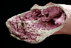 Stampe di All'interno di un osso. Micrografo elettronico scannato colorato (SEM) di uno stuzzicadenti rotto per mostrare il suo interno Immagini datate 2007 aprile: Interfaccia di un osso, SEM