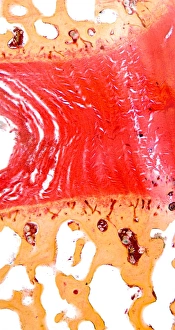 Light Micrograph Stampe: Intervertebral disc, light micrograph