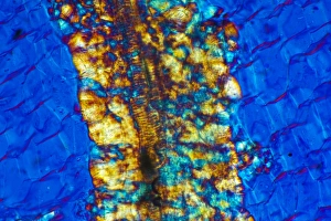 Polarised Light Microscopy Stampe: Inulin crystals, light micrograph