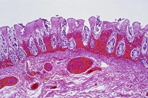 Immagini datate 27 marzo 2013: Intestino ischeamico, fotografia a lente leggera