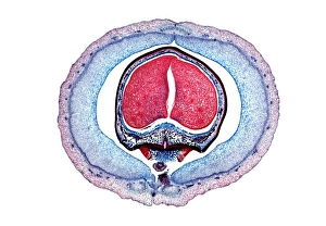 Light Microscopy Images Stampe: Kidney bean, light micrograph
