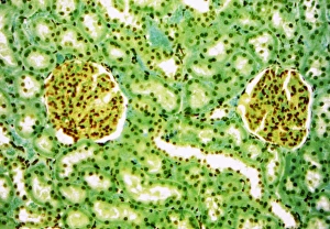 Stampe di Globi renali del fegato. Microscopio a luce bianca di una sezione attraverso la corteccia di un rene sano mostrando globuli Immagini datate 2007 ottobre: Globuli renali del bambino, fotografia a lente di ingrandimento leggera
