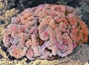Stampe di Il glomerulus è un sottile ballone di capillari dove il sangue che passa attraverso i reni viene filtrato Immagini datate 2000: Globetto renale