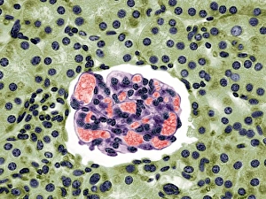 Stampe di Il glomero del renale. Micrografico di luce colorata di una sezione attraverso la cortezza sano del rene, mostrando un glomerulo Immagini datate 2008 dicembre: Globolo renale del bambino, fotografia a lente di raggi X leggera