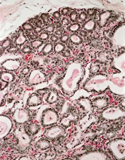 Corpo Umano Stampe: Tessuto del seno in fase di allattamento, micrografia a lente leggera