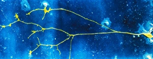 Human Nervous System Anatomy Stampe: Light micrograph of a nerve cell