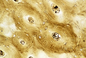 Stampe di Microscopia di luce del sezione trasversale della tessuta ossea compatta umana normale, come trovata nelle estremità delle ossa lunghe quali il femore Immagini datate 2003 ottobre: Micrografo di luce della ossa umana compatta normale