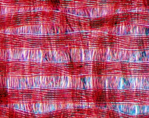 Light Microscopy Images Stampe: Light micrograph of polyamide in tissue