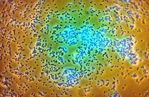 Staphylococcus Aureus Bacteria Stampe: LM of staphylococcus aureus